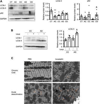 Autophagy is Involved in Cardiac Remodeling in Response to Environmental Temperature Change